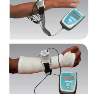 Melmak Fracture Healing System