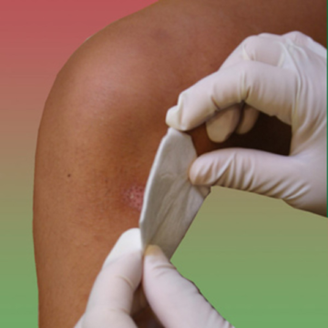 Melolite Low Adherent Wound Dressing