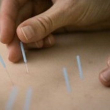 Acupuncture Needles & Supplies