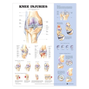 Knee Injuries