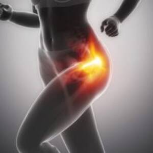 Trochanteric Bursitis
