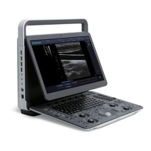 Sonoscape E1 Real Time Ultrasound