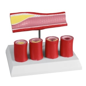 Artery with 4 artery sections – EZ Augmented Anatomy