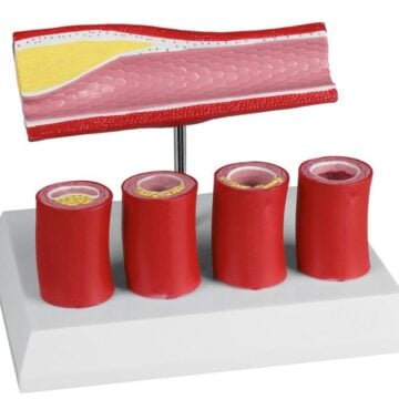 Artery with 4 artery sections - EZ Augmented Anatomy
