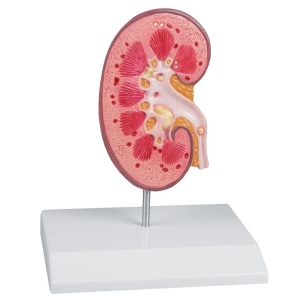 Kidney Stone Model – EZ Augmented Anatomy