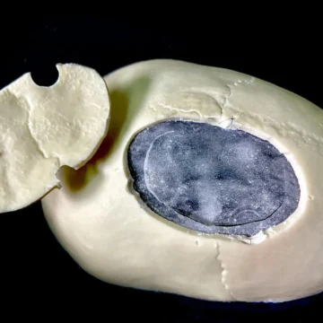 Burr-Holes Simulator