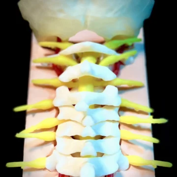 Craniocervical Junction Surgery Simulator