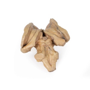 Brain stem, deep cerebral and diencephalic structures