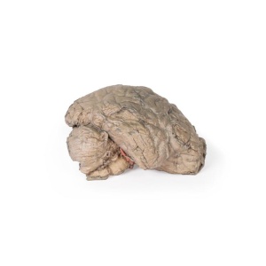 Brain Hemisection