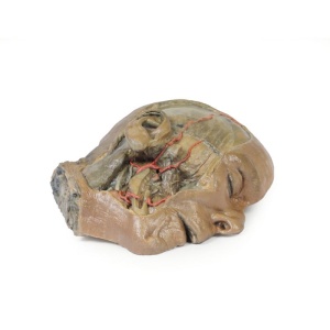 3D Printed Anatomical Models