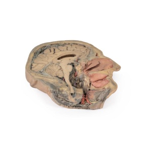 Median Section through head sagittal section of head with deep dissection