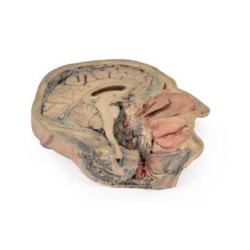 Median Section through head sagittal section of head with deep dissection