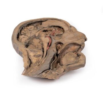 Parasagittal Section of the head and neck