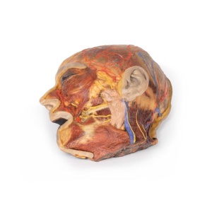 Superficial Facial nerves & Parotid Gland
