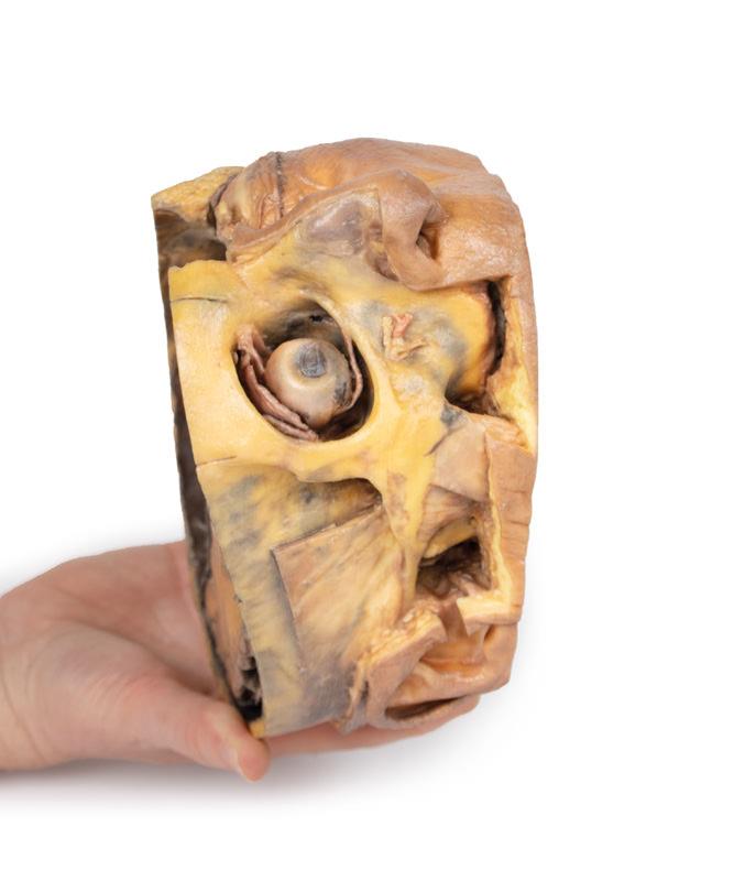 Transverse Section of the head - 6