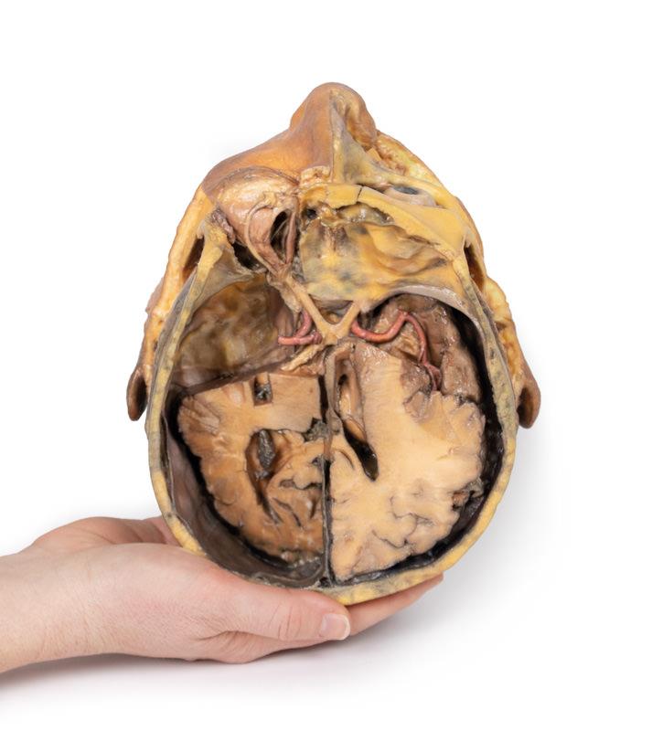 Transverse Section of the head - 7
