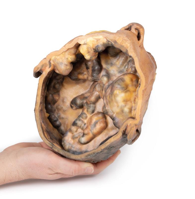 Transverse Section of the head - 8
