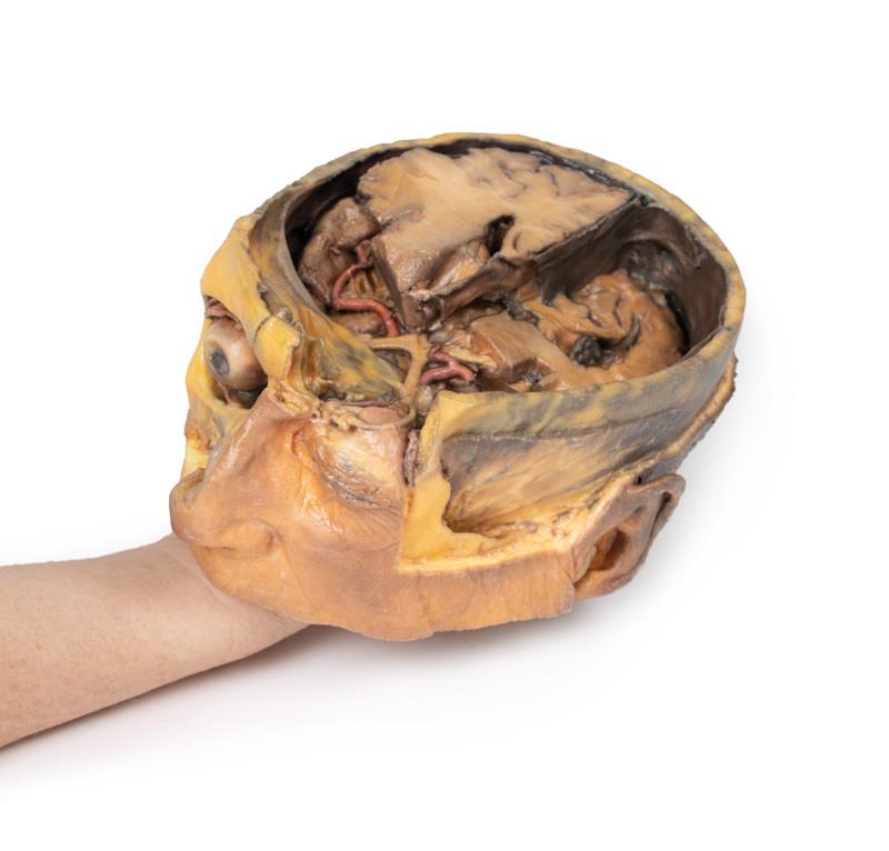 Transverse Section of the head - 9