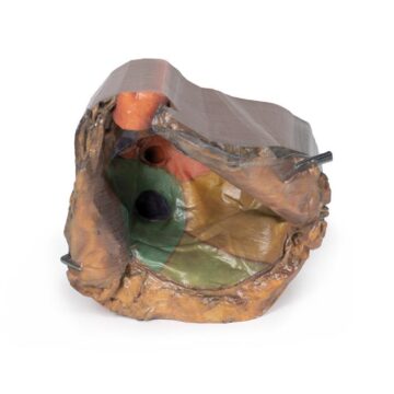 Pericardial space