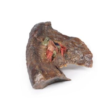 Hilum of the left lung