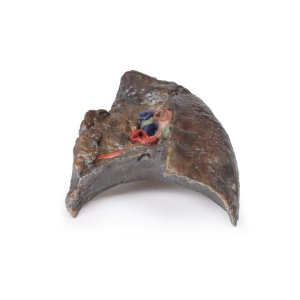 Hilum of the right lung