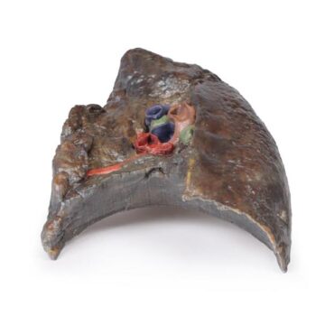 Hilum of the right lung