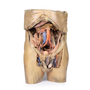 Abdomen with bilateral Hernias