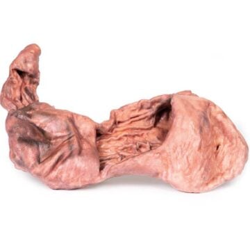 Stomach