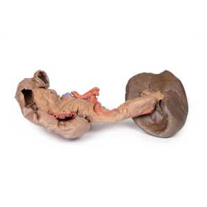 Spleen and pancreas