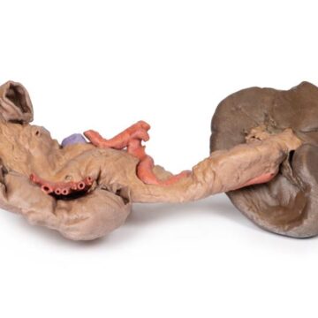 Spleen and pancreas
