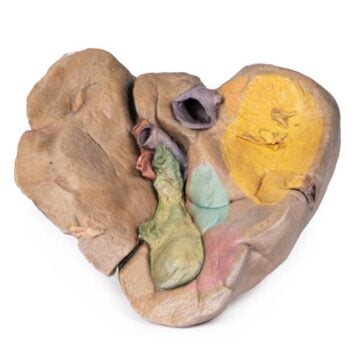 Liver with vessels and gallbladder