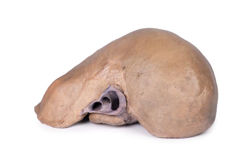 Liver with vessels and gallbladder - 3