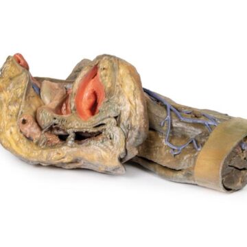 Female hemipelvis and thigh