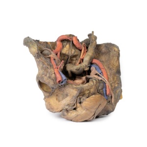 Female pelvis deep dissection