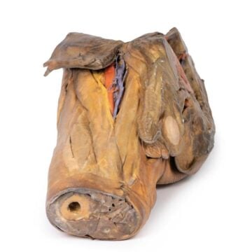 Male hemipelvis and thigh