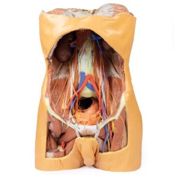 Posterior Abdominal wall