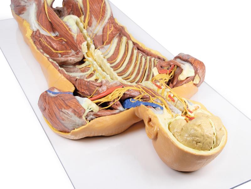 Posterior Body Wall / Ventral Deep Dissection - 11