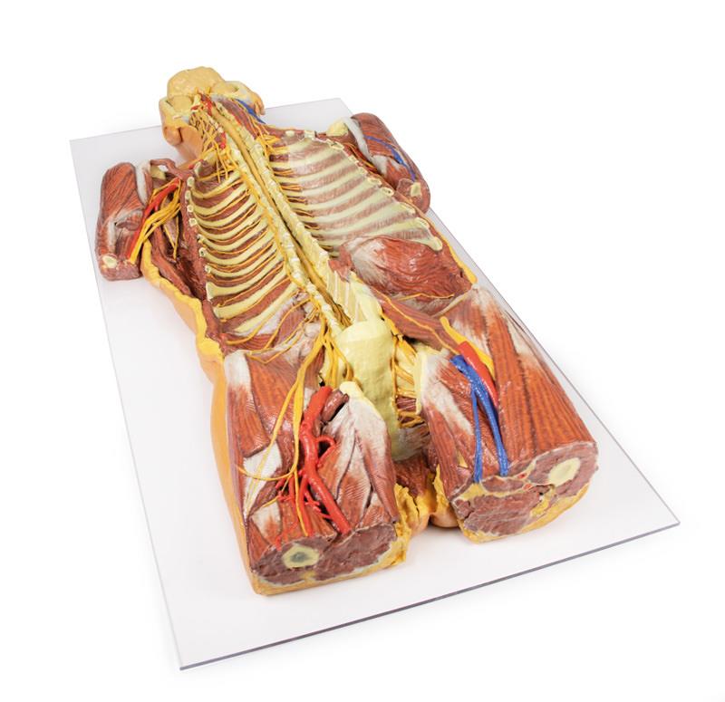 Posterior Body Wall / Ventral Deep Dissection - 2