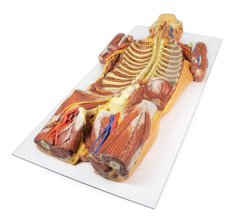 Posterior Body Wall / Ventral Deep Dissection - 3