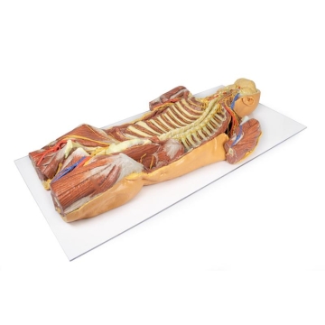 Posterior Body Wall / Ventral Deep Dissection - Australian ...