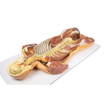 Posterior Body Wall / Ventral Deep Dissection - Australian ...