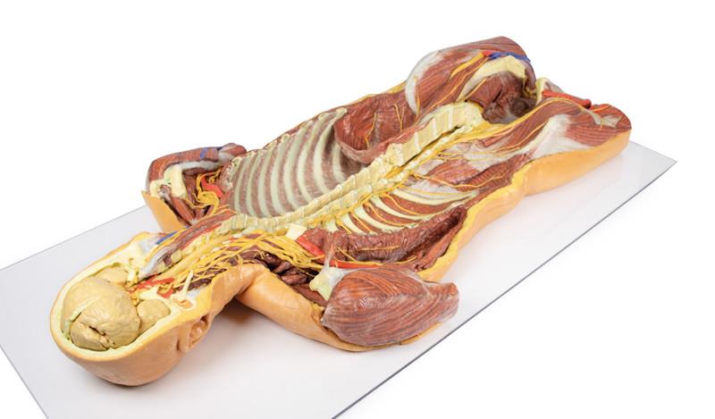 Posterior Body Wall / Ventral Deep Dissection - 7