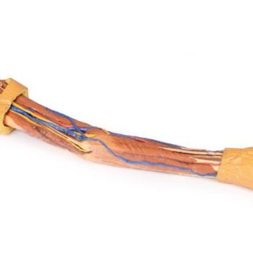 Upper Limb