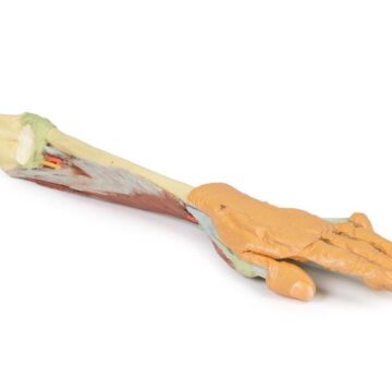 Forearm and hand - deep dissection