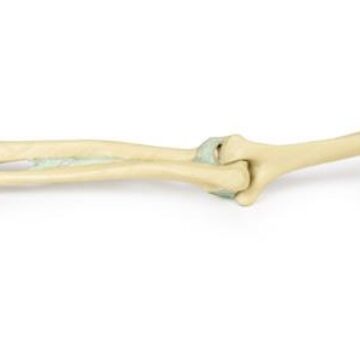 Upper Limb Ligaments