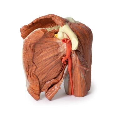 Shoulder (left) - Superficial muscles and axillary/brachial artery