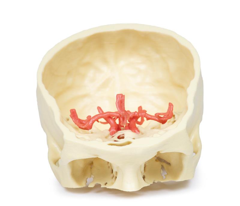 Circle of Willis - 2