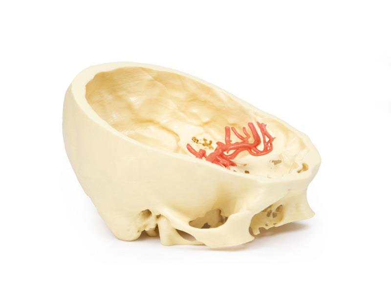 Circle of Willis - 3