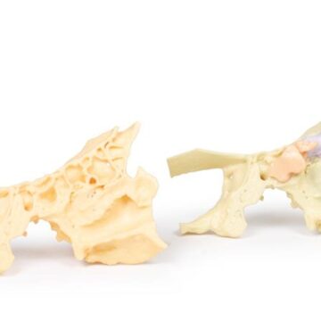 Paranasal Sinus model