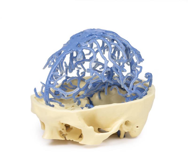 3D Printed Anatomy - Venous Circulation - 2
